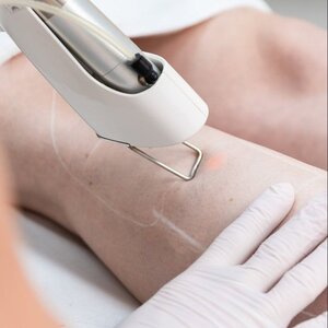 Huidzorg Laserklinieken image 2