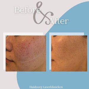 Huidzorg Laserklinieken image 4