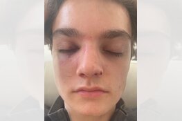 Gezocht: Zware mishandeling Brabanthallen