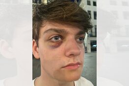 Gezocht: Zware mishandeling Brabanthallen