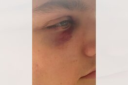 Gezocht: Zware mishandeling Brabanthallen